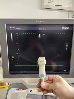 Toshiba PST-25BT Phased Array Ultrasound Probe thumbnail 4