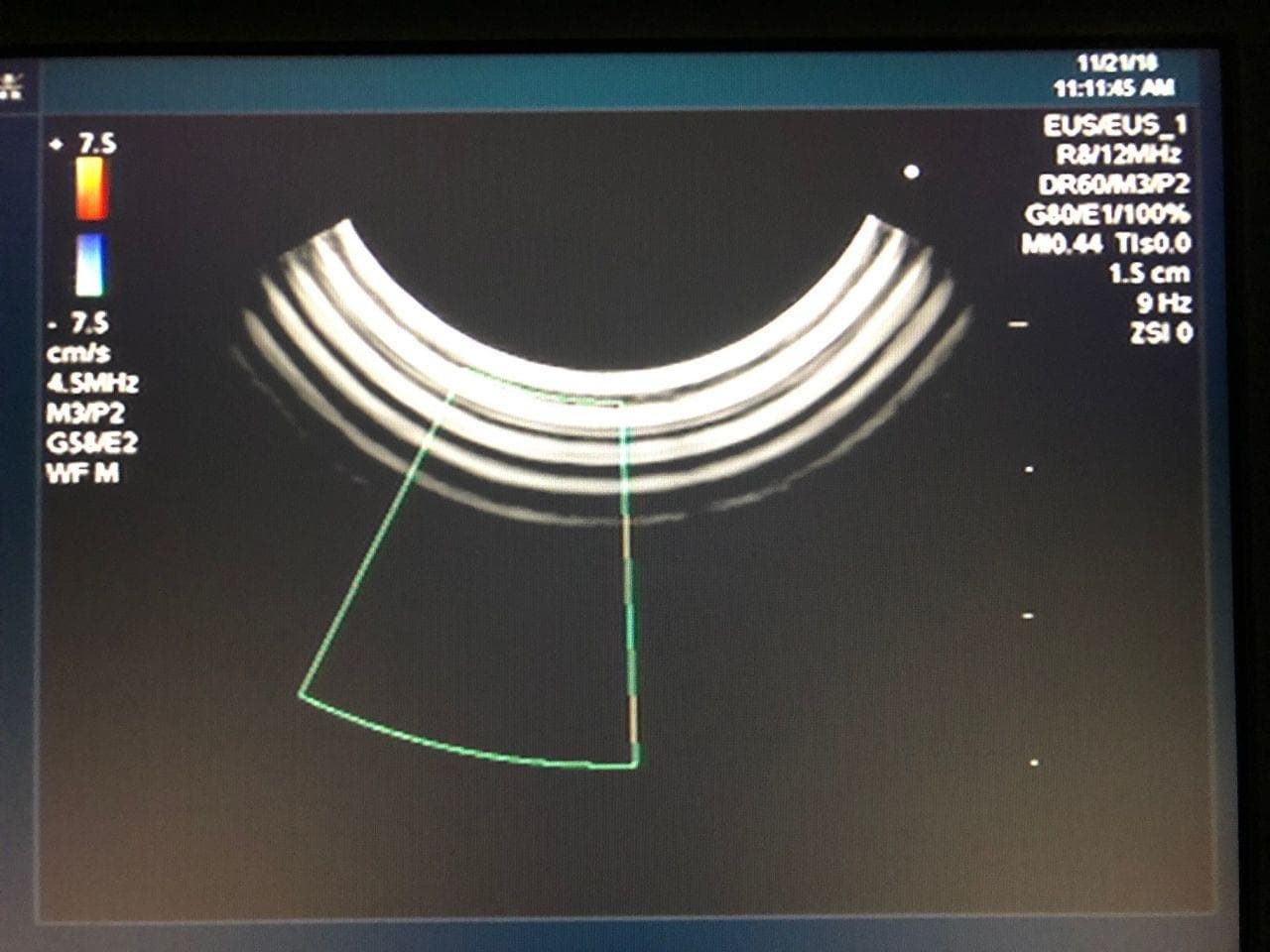 FUJIFILM EG-530UT2 — Ultrasound Video Gastroscope thumbnail 4