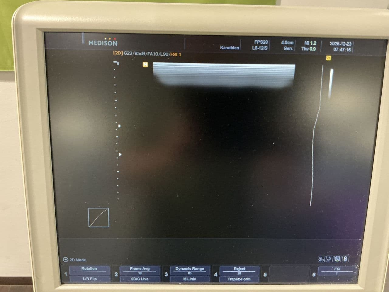 For Sale SAMSUNG Accuvix V10 Cardiac - Vascular Ultrasound thumbnail 2