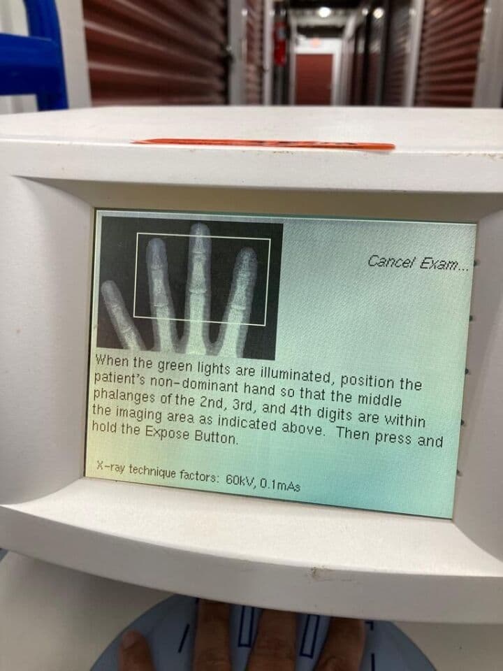 Osteoporosis Screening Bone Densitometer — Alara MetriScan thumbnail 5