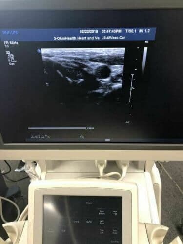 Philips L8-4 Linear Array Ultrasound Transducer Probe thumbnail 2