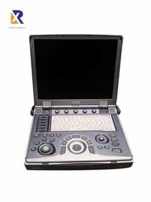 GE Logiq i Portable Ultrasound System image 1