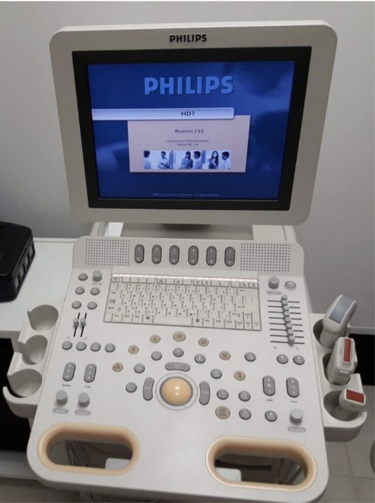 Philips HD7 Ultrasound System image 1
