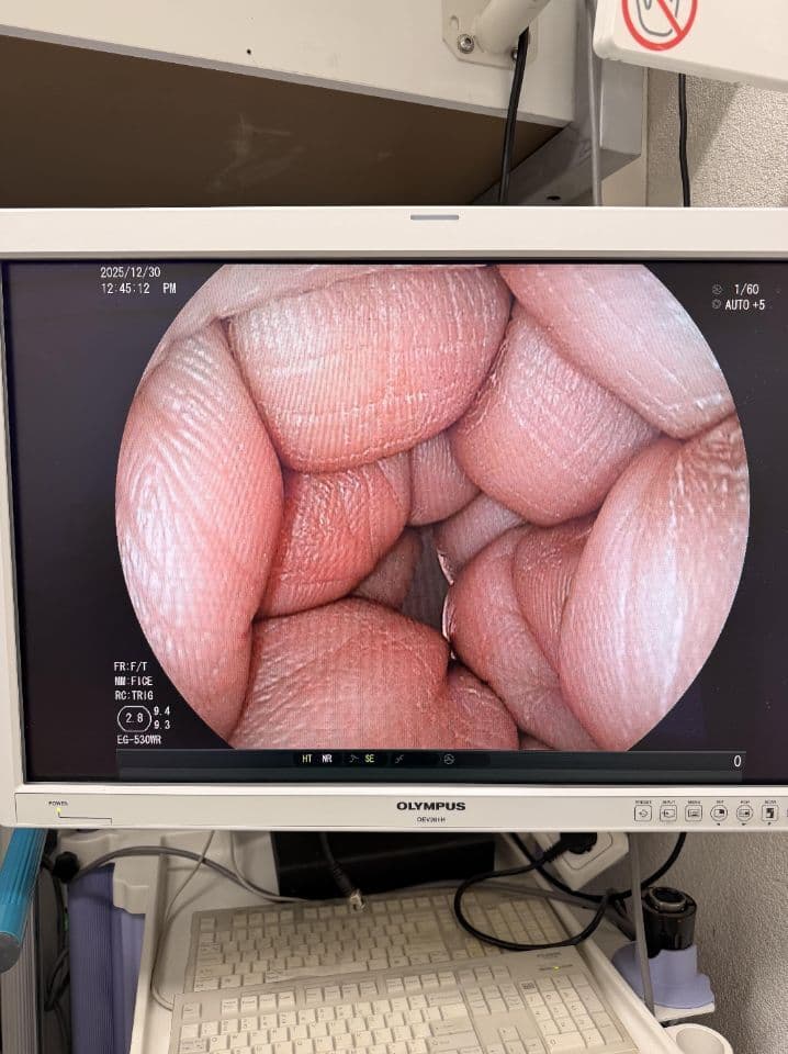 For Sale FUJINON EG-530WR Gastroscope thumbnail 4