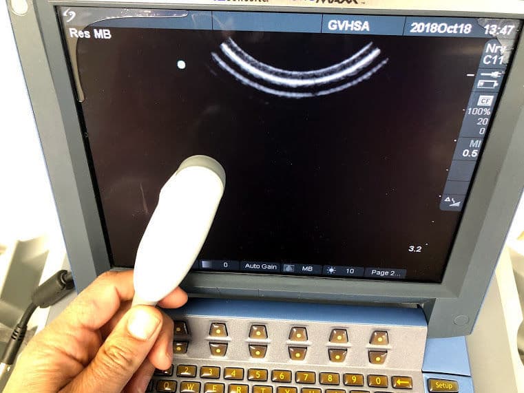 Sonosite C11E Micro-Convex Ultrasound Probe thumbnail 2