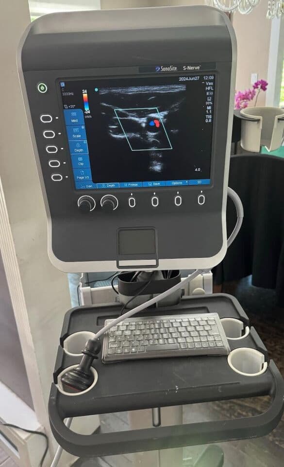 Sonosite S-Nerve Ultrasound System with Cart and L38x Vascular Probe thumbnail 5