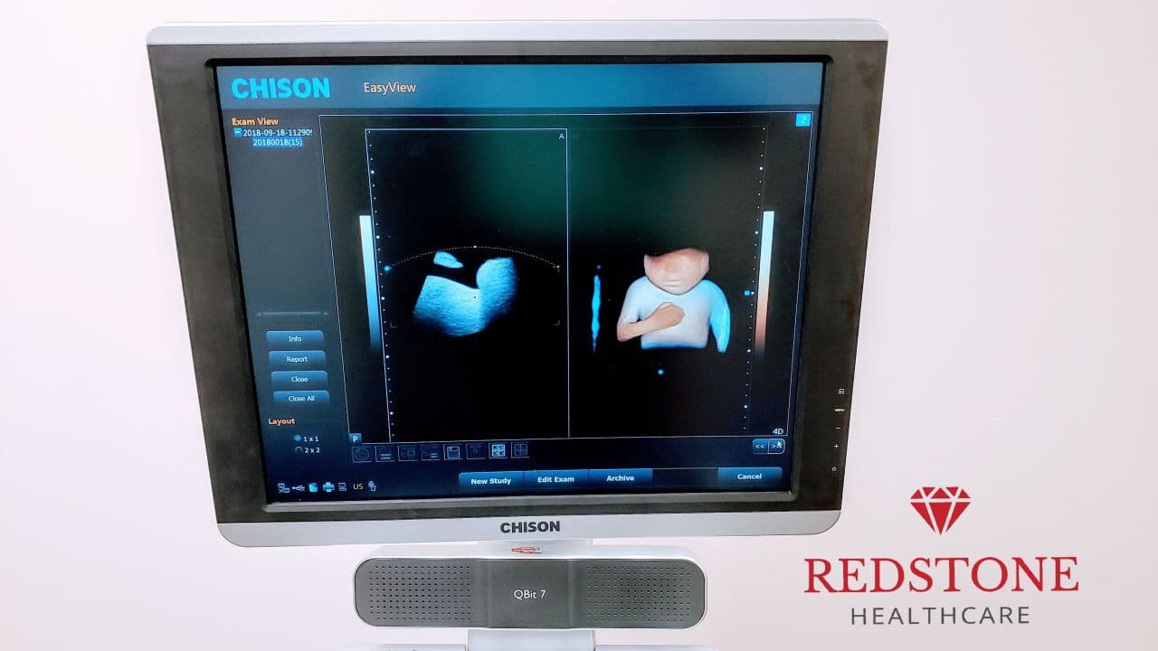 Chison QBit 7 4D Digital Color Doppler Ultrasound System thumbnail 4