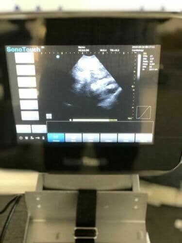 CHISON Sonotouch 30 Portable Ultrasound System with Touchscreen Interface thumbnail 9