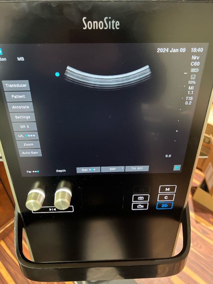 Sonosite S2 MSK Musculoskeletal Ultrasound System thumbnail 5