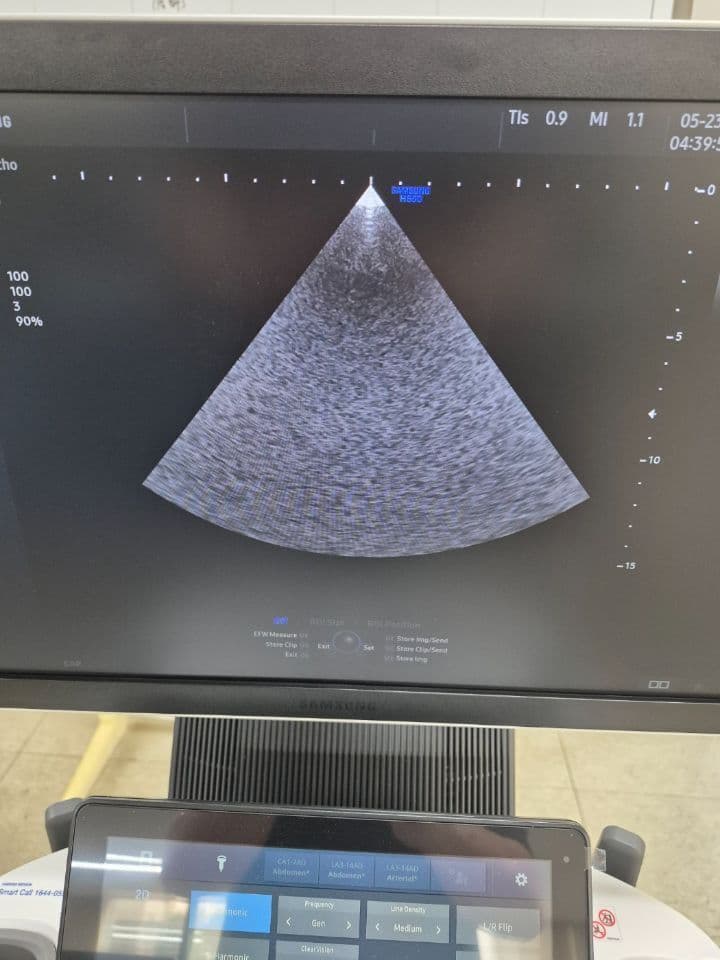 Cardiac Sector Samsung PE2-4 Ultrasound Transducer thumbnail 5