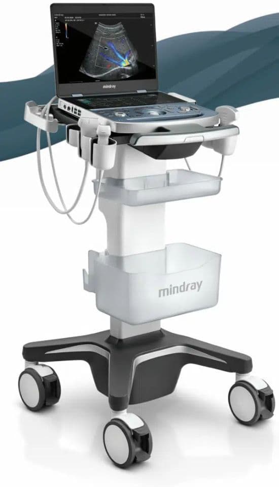 Mindray MX7 Portable Ultrasound System image 1