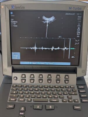 SonoSite C11x Micro-Convex Ultrasound Transducer thumbnail 10
