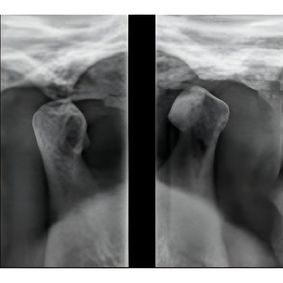 Carestream CS8100 Pano Panoramic Dental X-Ray System thumbnail 3