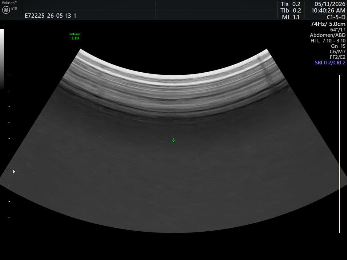 GE Healthcare C1-5-D Curved Array Ultrasound Transducer thumbnail 3