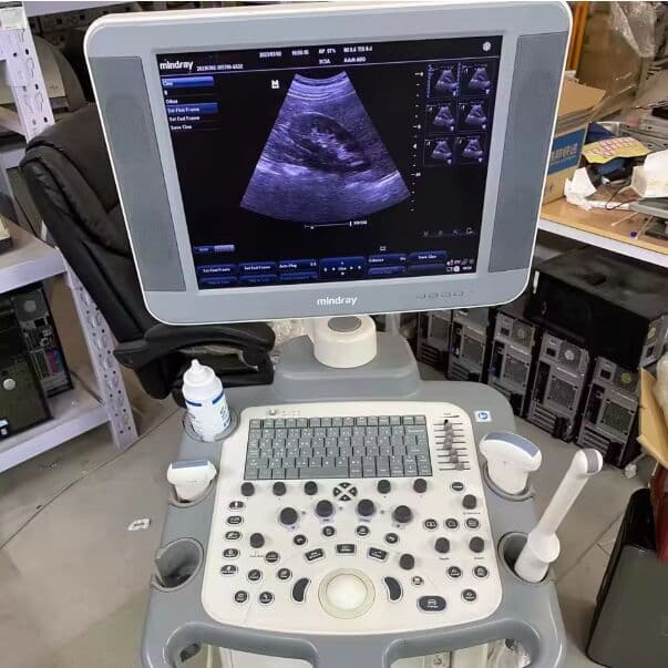 Mindray DC-N6 Trolley Color Doppler Ultrasound System image 1