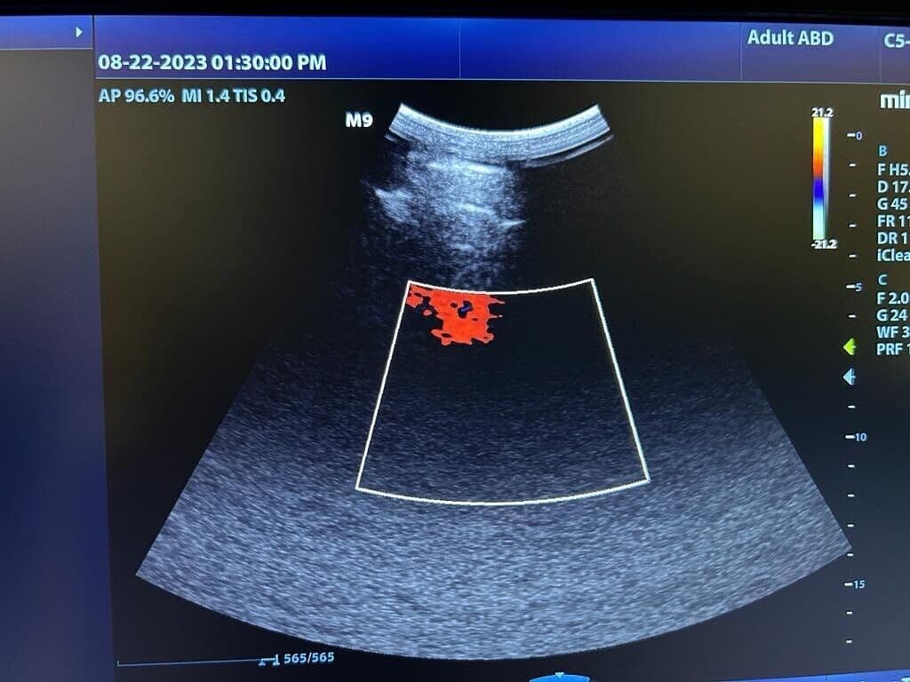 Mindray C5-1 Curved Array Ultrasound Transducer thumbnail 2