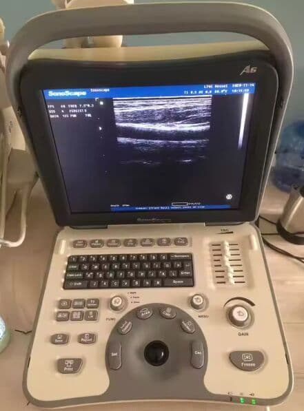 SonoScape A6 Portable B/W Ultrasound Scanner thumbnail 2