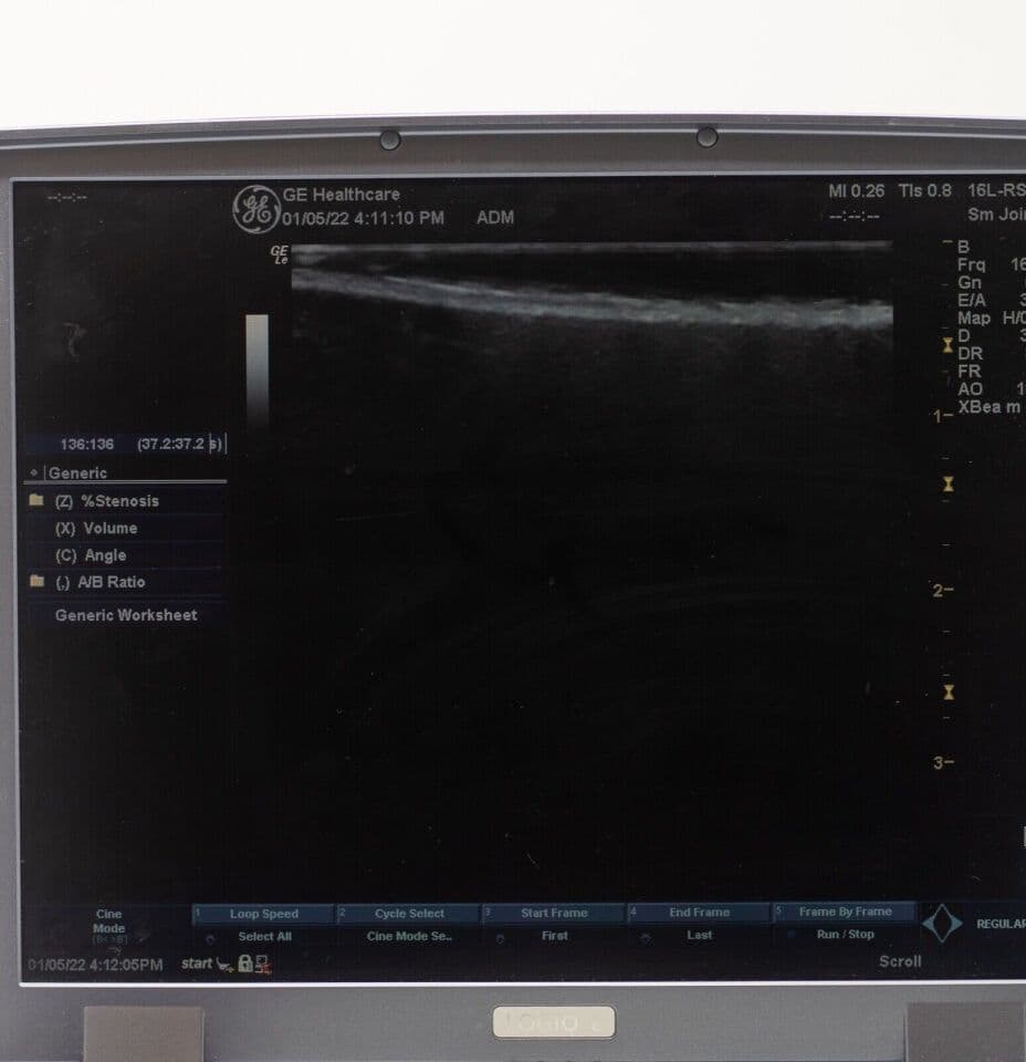 GE 16L-RS Linear Ultrasound Transducer thumbnail 2