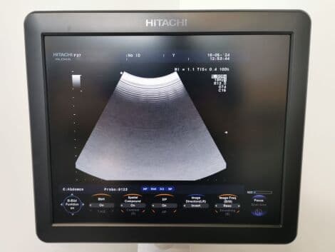 Hitachi Aloka F-37 Ultrasound System with UST-9123, UST-568, and UST-9124 Probes thumbnail 8