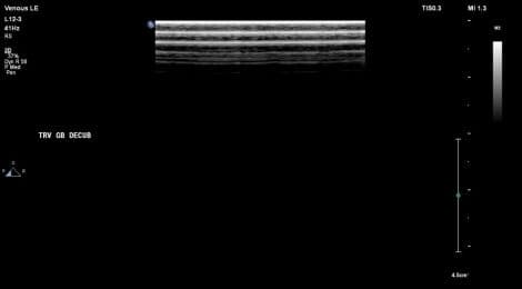 Philips L12-3 Linear Array Ultrasound Transducer thumbnail 6