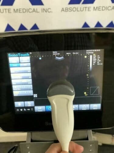 CHISON Sonotouch 30 Portable Ultrasound System with Touchscreen Interface thumbnail 8