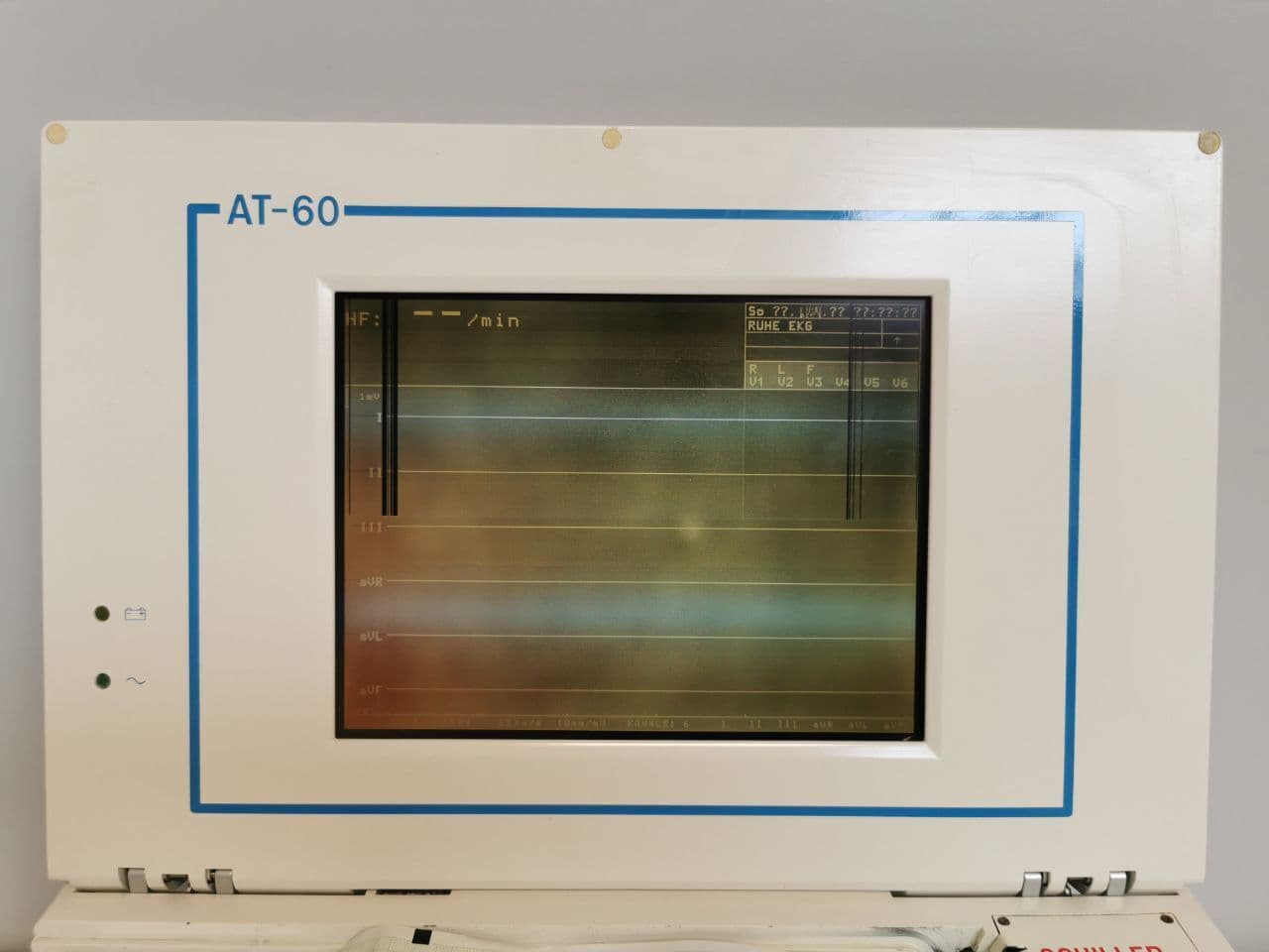 Portable 3-Channel ECG Unit by Schiller — Cardiovit AT-60 thumbnail 6