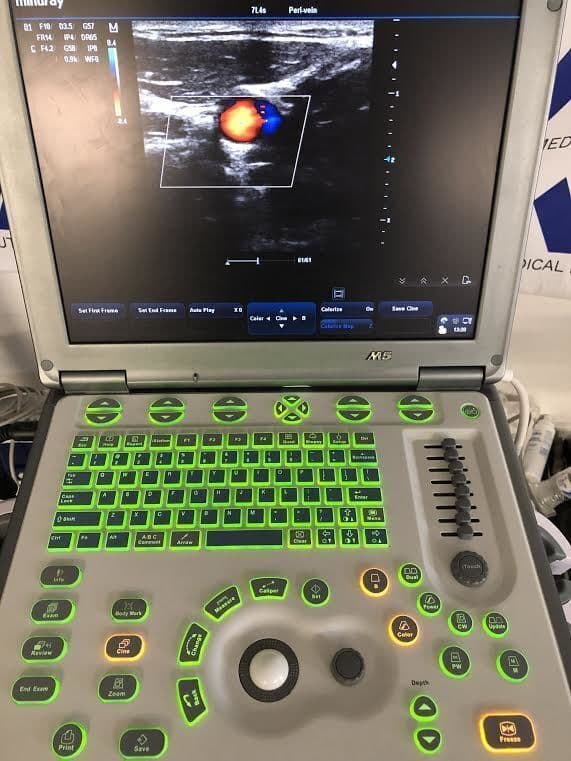 Mindray M5 Portable Ultrasound System thumbnail 6