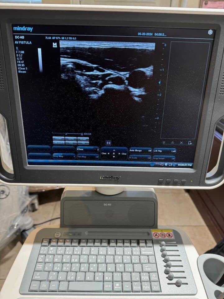Mindray DC-N3 OB/GYN & Vascular Diagnostic Ultrasound System thumbnail 3