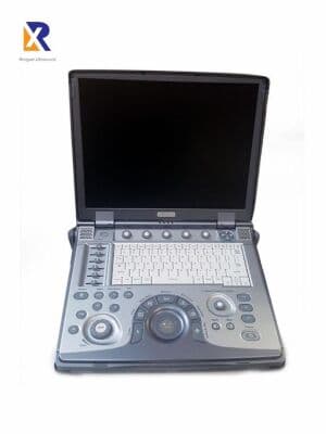 GE Logiq e Portable Ultrasound System image 1