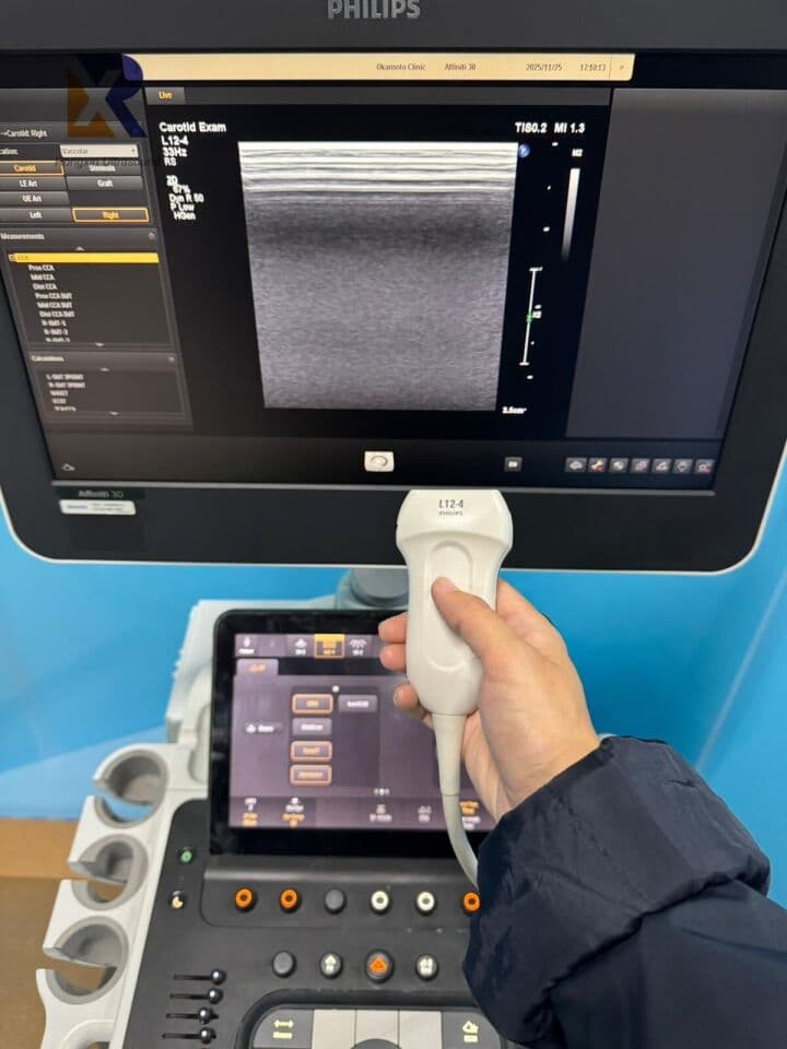 Philips Affiniti 30 Ultrasound System for OB/GYN Applications thumbnail 2
