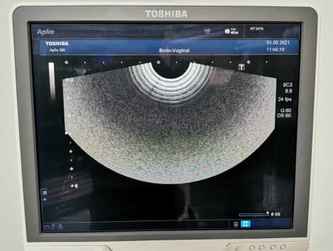 Endovaginal Ultrasound Transducer — Toshiba PVT-661VT thumbnail 6