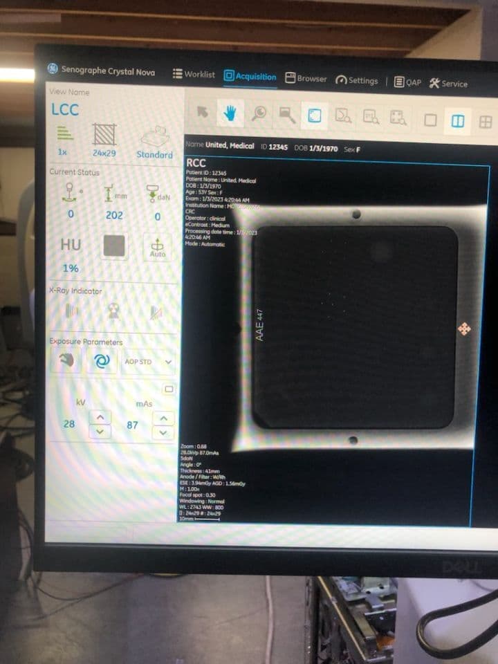 GE Stenograph Crystal Nova 2D Digital Mammography System thumbnail 5
