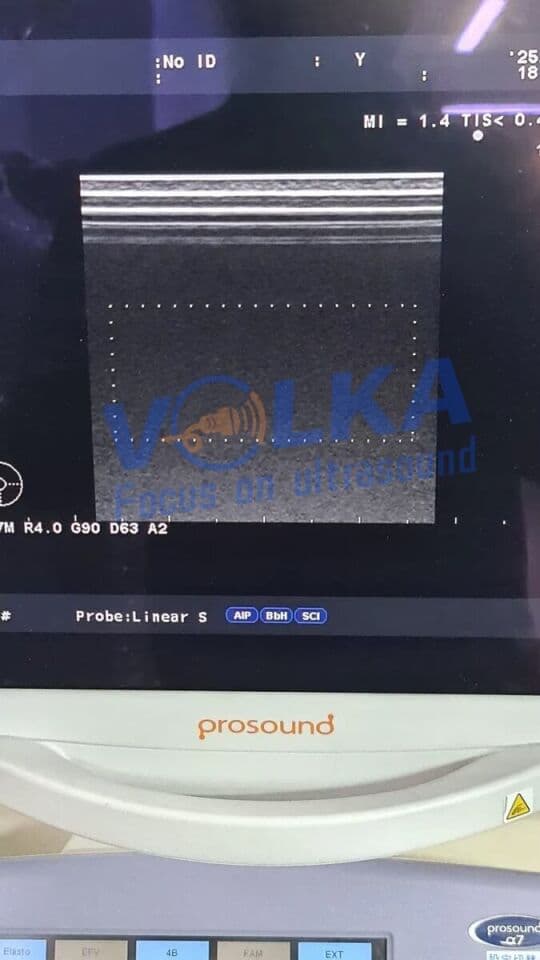 Aloka UST-5412 Ultrasound Transducer thumbnail 3