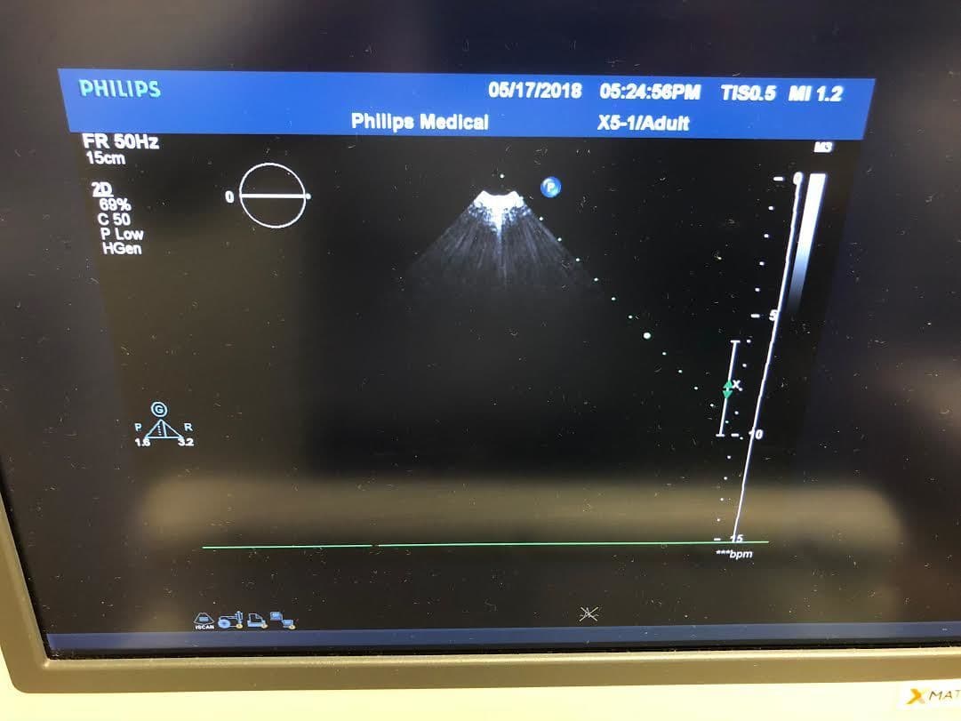 Philips X5-1 X-Matrix Phased Array Ultrasound Transducer thumbnail 4