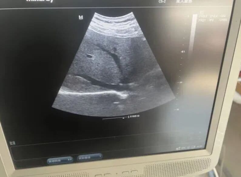 Mindray DC-7 Ultrasound Machine thumbnail 2