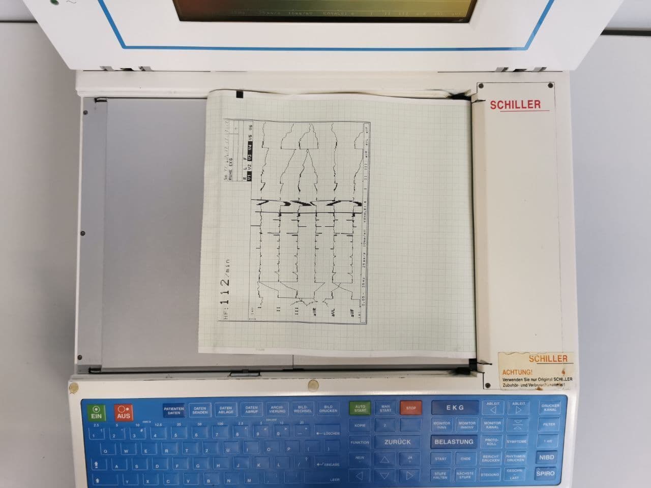 Portable 3-Channel ECG Unit by Schiller — Cardiovit AT-60 thumbnail 7
