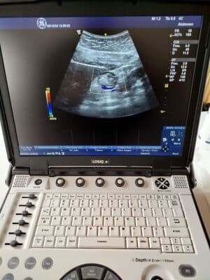 GE Logiq E Portable Ultrasound System thumbnail 9