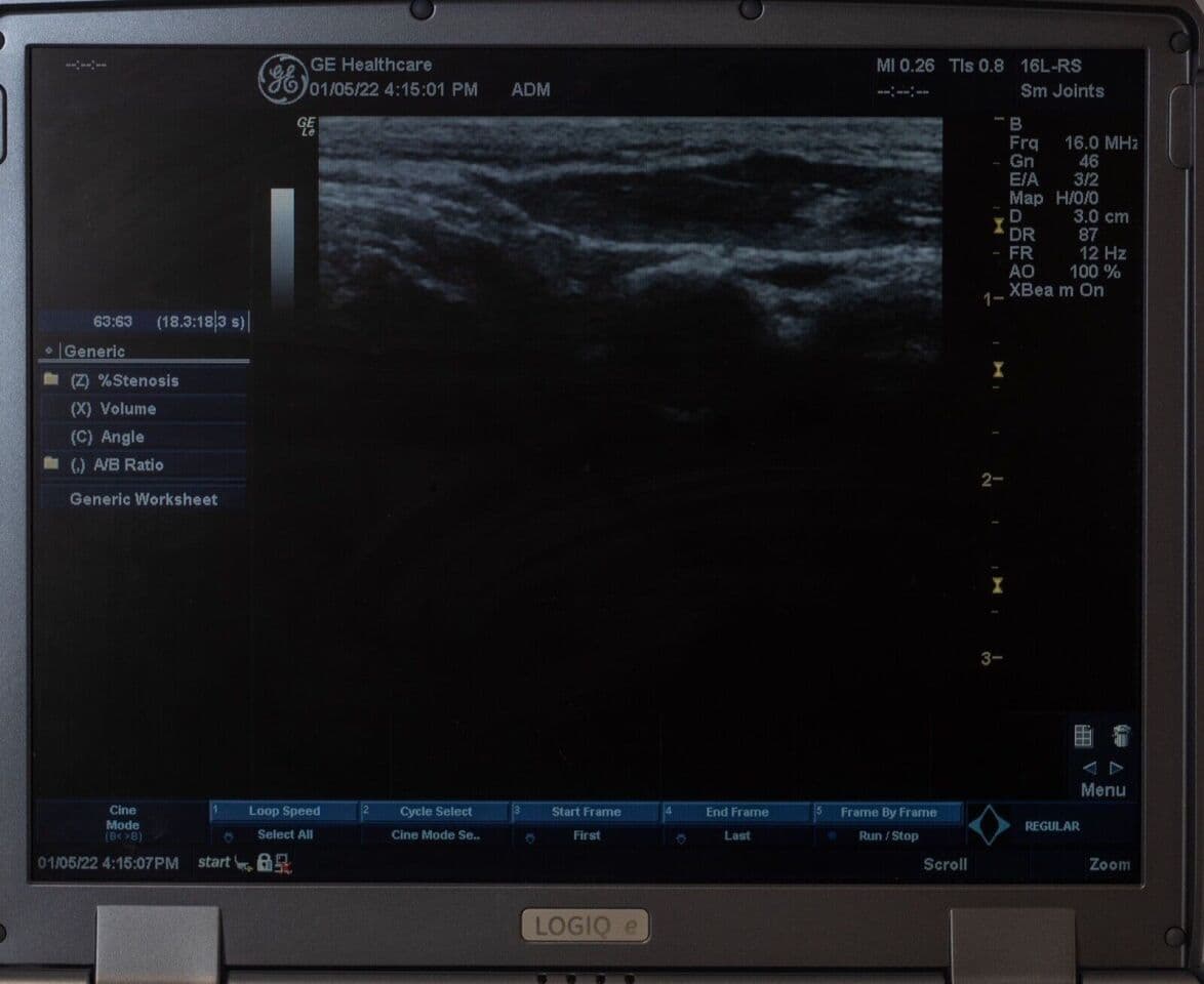 GE 16L-RS Linear Ultrasound Transducer thumbnail 3