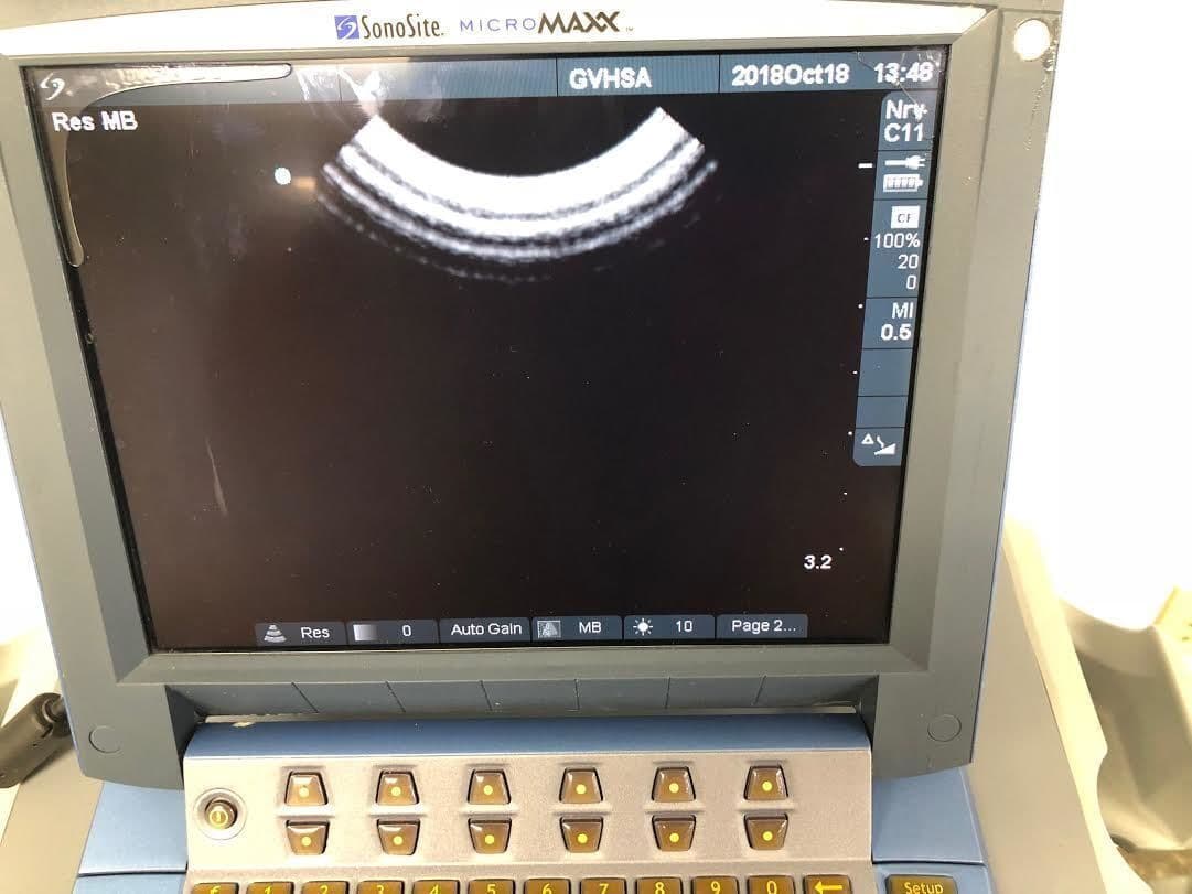 SonoSite C11E Curved Array Ultrasound Transducer for MicroMaxx System thumbnail 3