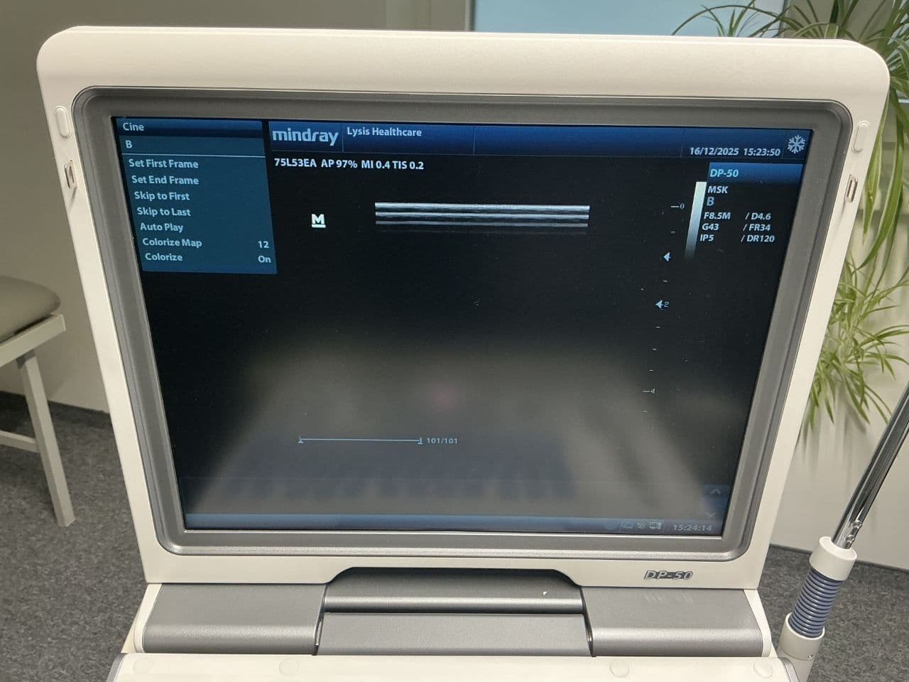 For Sale MINDRAY DP-50 Vascular - Small Parts Ultrasound thumbnail 3