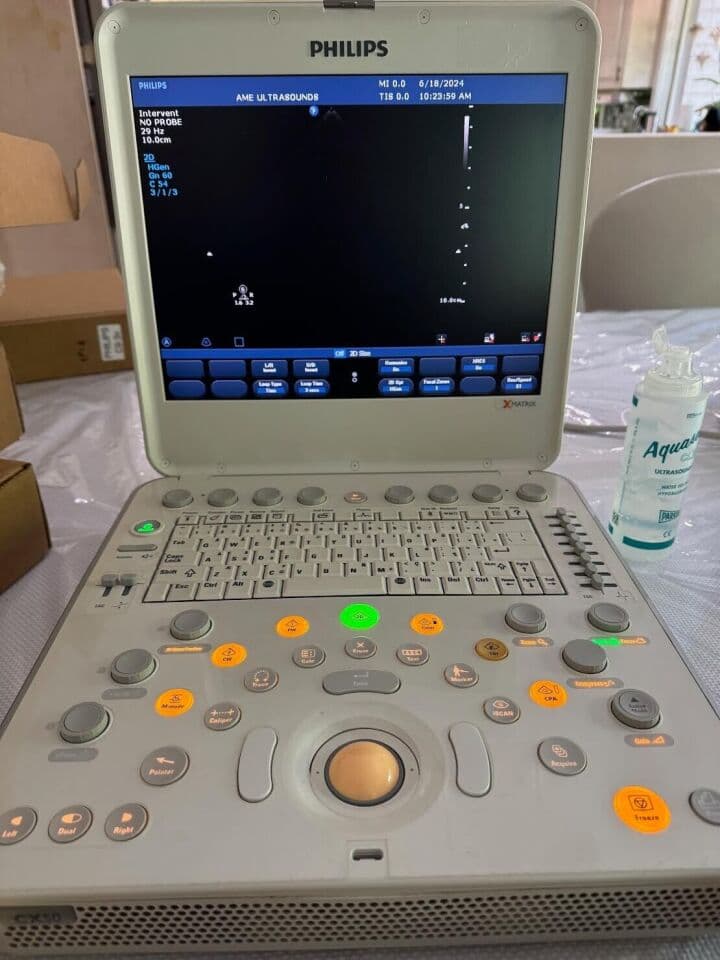 Philips CX50 Portable Cardiac Ultrasound System thumbnail 5