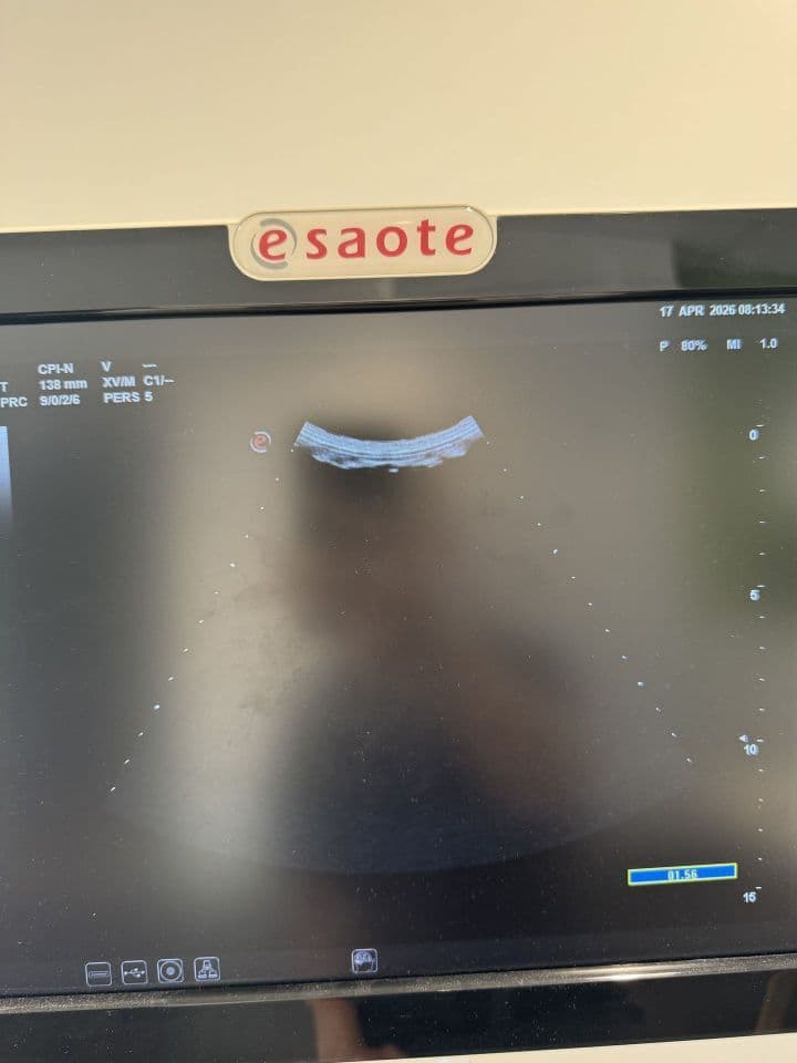 For Sale ESAOTE MyLab Seven Cardiac - Vascular Ultrasound thumbnail 4