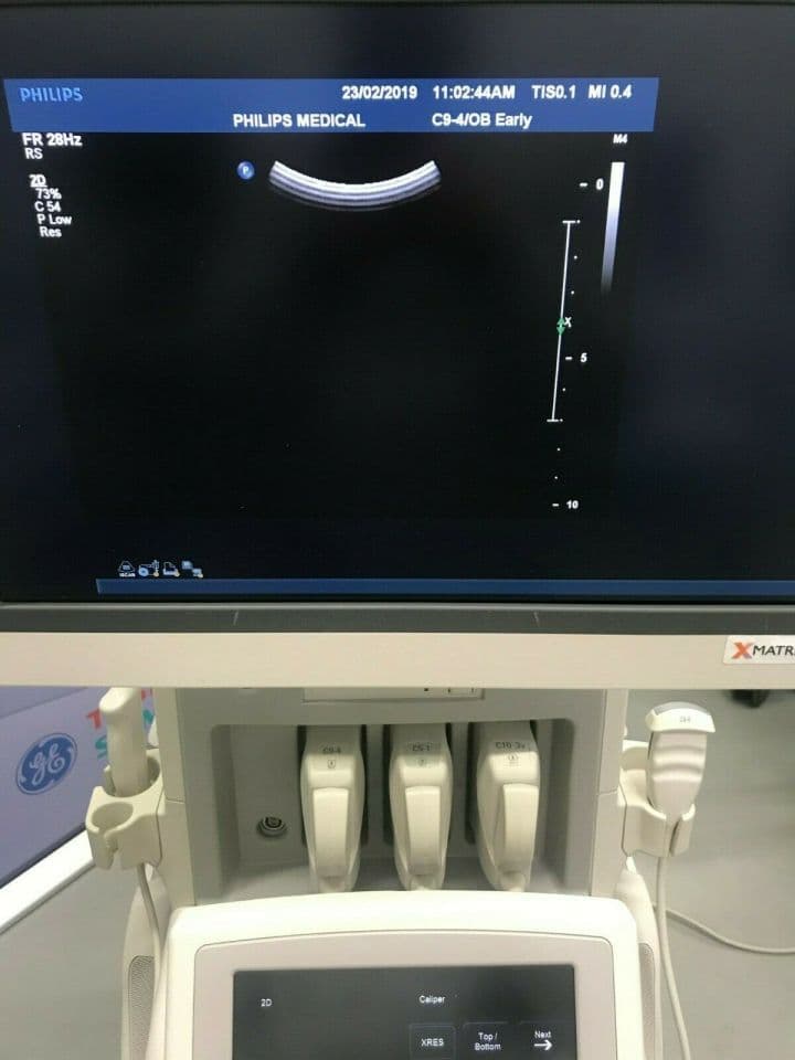 Philips C5-2 Curved Array Ultrasound Transducer image 1
