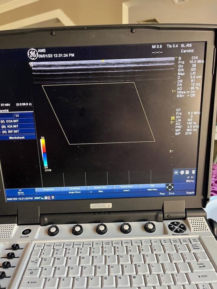 GE 9L-RS Linear Array Ultrasound Transducer for Vascular and Small Parts Imaging thumbnail 4