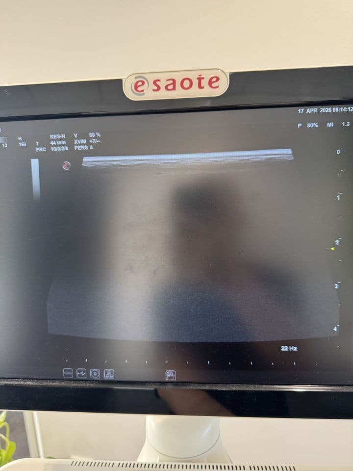 For Sale ESAOTE MyLab Seven Cardiac - Vascular Ultrasound thumbnail 6