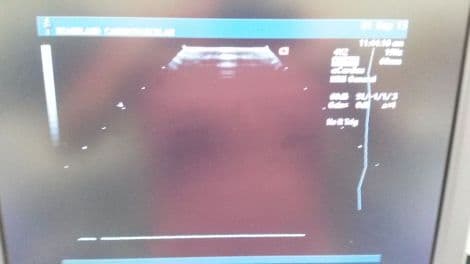 Acuson 4V2 Vector Array Ultrasound Transducer thumbnail 4
