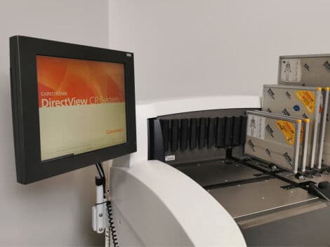 Kodak DirectView CR 975 Computed Radiography System thumbnail 5