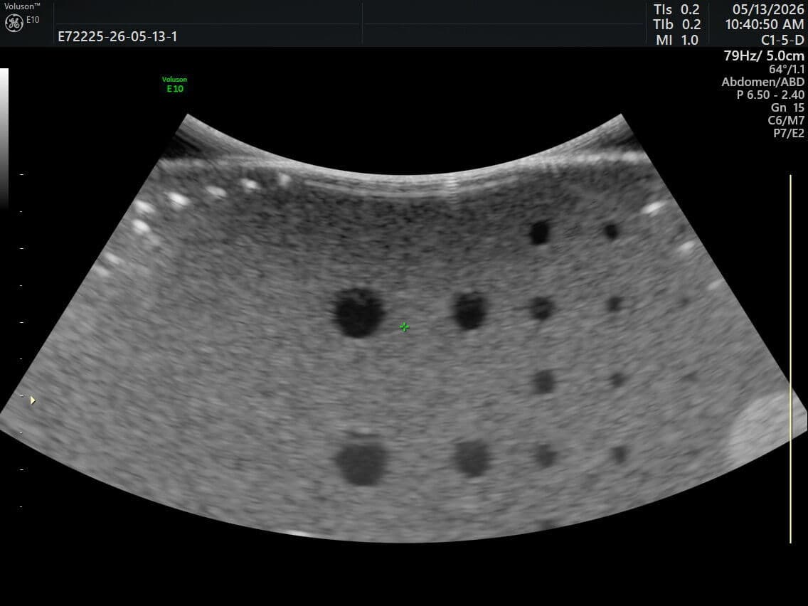 GE Healthcare C1-5-D Curved Array Ultrasound Transducer thumbnail 4