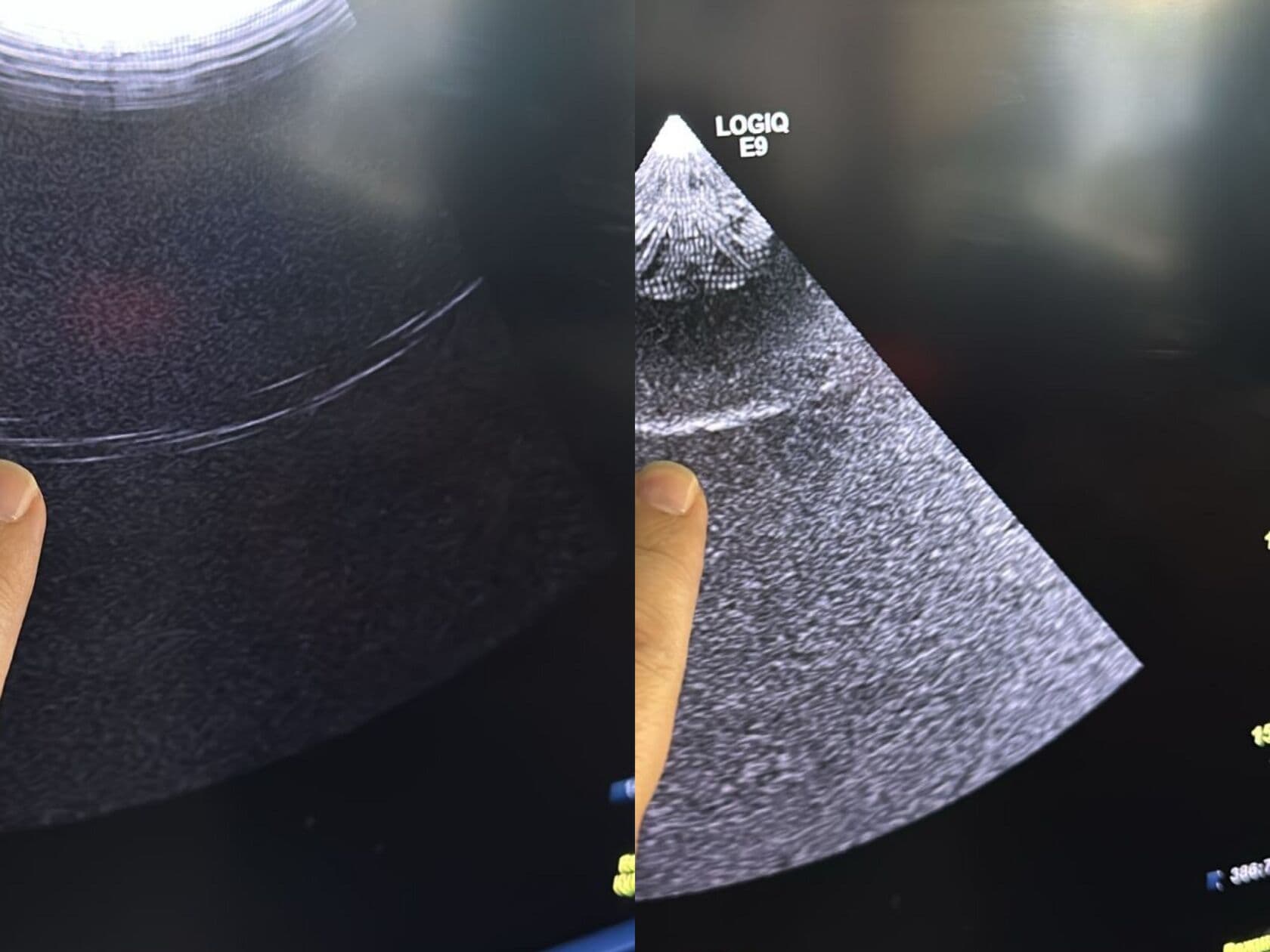 GE Healthcare Logiq E9 R6 Ultrasound System image 1