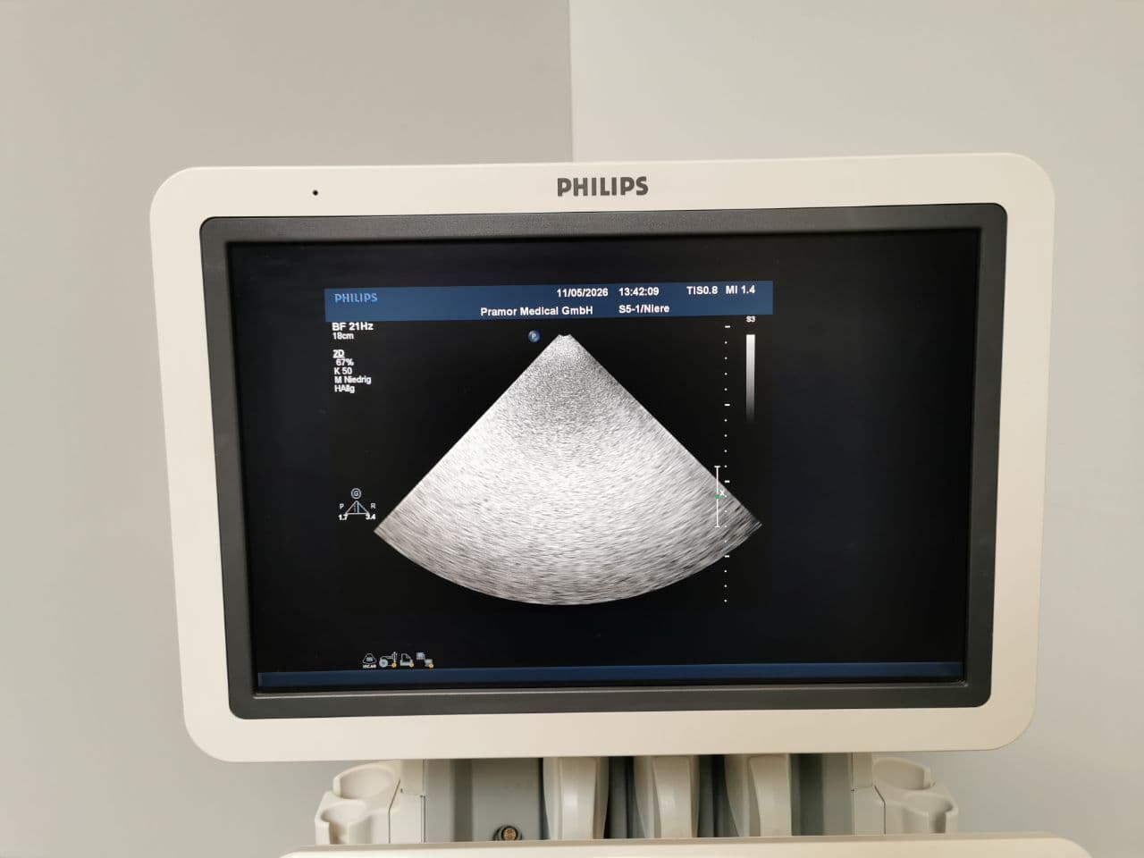 Cardiac Ultrasound System — Philips iE33 thumbnail 8
